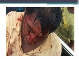 Violência contra os índios