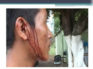 Violência contra os índios