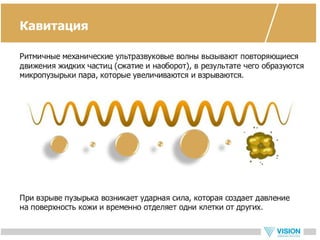 Vip ultrasonic - новый прибор для ухода за кожей