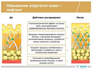 Vip ultrasonic - новый прибор для ухода за кожей