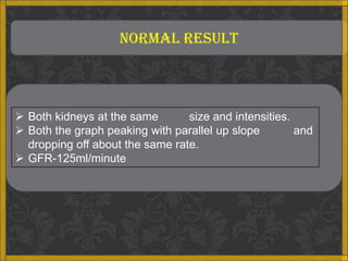 NORMAL RESULT



 Both kidneys at the same       size and intensities.
 Both the graph peaking with parallel up slope        and
  dropping off about the same rate.
 GFR-125ml/minute
 