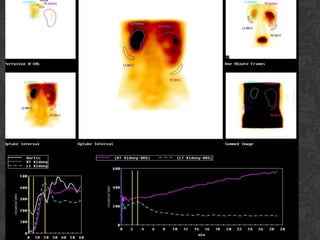 GIT and RENAL SYSTEM  NUCLEAR MEDICINE PROCEDURES