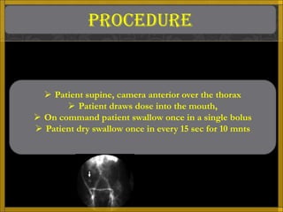 PROCEDURE


   Patient supine, camera anterior over the thorax
        Patient draws dose into the mouth,
 On command patient swallow once in a single bolus
 Patient dry swallow once in every 15 sec for 10 mnts
 
