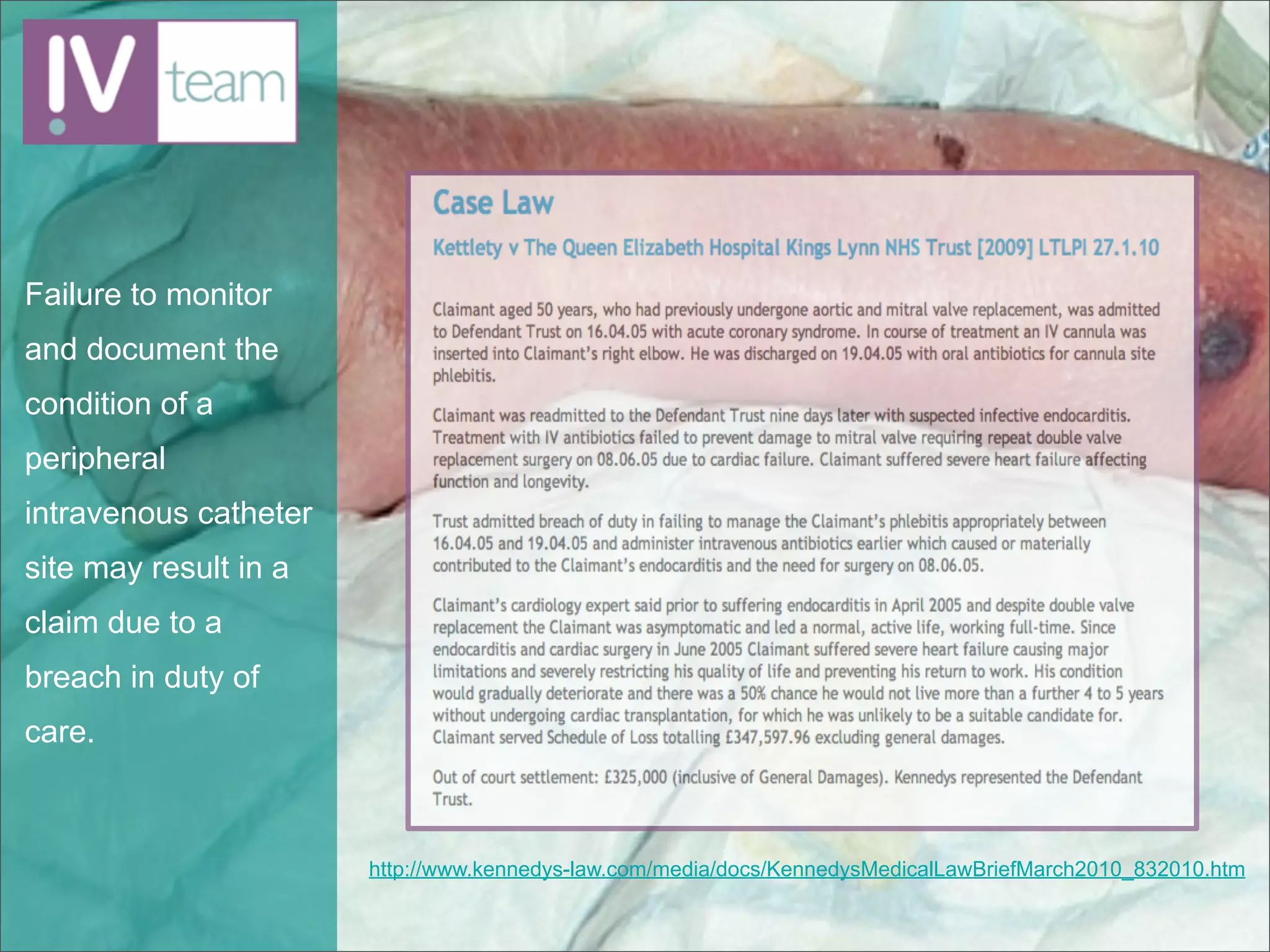 Failure to monitor
and document the
condition of a
peripheral
intravenous catheter
site may result in a
claim due to a
breach in duty of
care.



                       http://www.kennedys-law.com/media/docs/KennedysMedicalLawBriefMarch2010_832010.htm
 