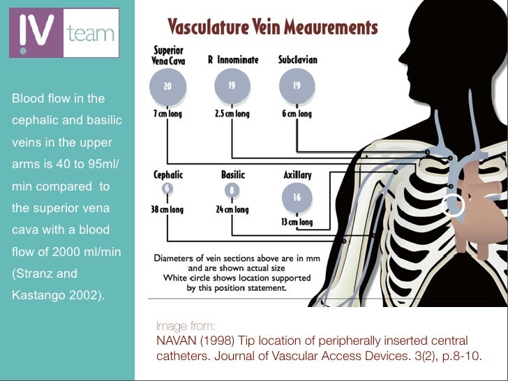 Introduction to the Visual Infusion Phlebitis (VIP) score
