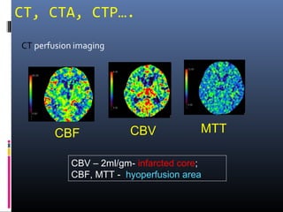 Intervention in Stroke-A New Era | PPT