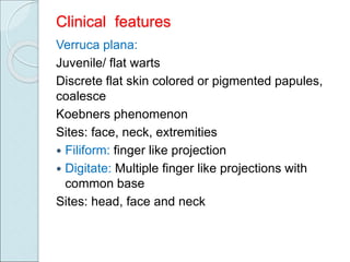 viral.ppt