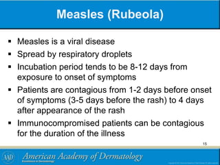 Measles (Rubeola)
 Measles is a viral disease
 Spread by respiratory droplets
 Incubation period tends to be 8-12 days from
exposure to onset of symptoms
 Patients are contagious from 1-2 days before onset
of symptoms (3-5 days before the rash) to 4 days
after appearance of the rash
 Immunocompromised patients can be contagious
for the duration of the illness
15
 
