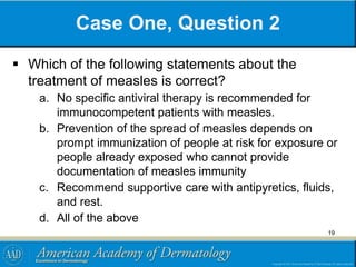 Case One, Question 2
 Which of the following statements about the
treatment of measles is correct?
a. No specific antiviral therapy is recommended for
immunocompetent patients with measles.
b. Prevention of the spread of measles depends on
prompt immunization of people at risk for exposure or
people already exposed who cannot provide
documentation of measles immunity
c. Recommend supportive care with antipyretics, fluids,
and rest.
d. All of the above
19
 