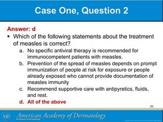Case One, Question 2
Answer: d
 Which of the following statements about the treatment
of measles is correct?
a. No specific antiviral therapy is recommended for
immunocompetent patients with measles.
b. Prevention of the spread of measles depends on prompt
immunization of people at risk for exposure or people
already exposed who cannot provide documentation of
measles immunity
c. Recommend supportive care with antipyretics, fluids,
and rest.
d. All of the above
20
 