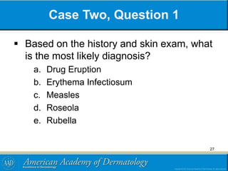 Case Two, Question 1
 Based on the history and skin exam, what
is the most likely diagnosis?
a. Drug Eruption
b. Erythema Infectiosum
c. Measles
d. Roseola
e. Rubella
27
 
