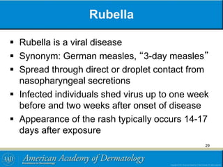 Rubella
 Rubella is a viral disease
 Synonym: German measles, “3-day measles”
 Spread through direct or droplet contact from
nasopharyngeal secretions
 Infected individuals shed virus up to one week
before and two weeks after onset of disease
 Appearance of the rash typically occurs 14-17
days after exposure
29
 