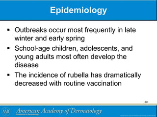 Epidemiology
 Outbreaks occur most frequently in late
winter and early spring
 School-age children, adolescents, and
young adults most often develop the
disease
 The incidence of rubella has dramatically
decreased with routine vaccination
30
 