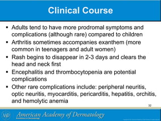 Clinical Course
 Adults tend to have more prodromal symptoms and
complications (although rare) compared to children
 Arthritis sometimes accompanies exanthem (more
common in teenagers and adult women)
 Rash begins to disappear in 2-3 days and clears the
head and neck first
 Encephalitis and thrombocytopenia are potential
complications
 Other rare complications include: peripheral neuritis,
optic neuritis, myocarditis, pericarditis, hepatitis, orchitis,
and hemolytic anemia
32
 