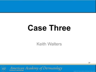 Case Three
Keith Walters
37
 