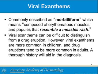Viral Exanthems
 Commonly described as “morbilliform” which
means “composed of erythematous macules
and papules that resemble a measles rash.”
 Viral exanthems can be difficult to distinguish
from a drug eruption. However, viral exanthems
are more common in children, and drug
eruptions tend to be more common in adults. A
thorough history will aid in the diagnosis.
4
 