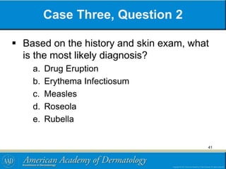 Case Three, Question 2
 Based on the history and skin exam, what
is the most likely diagnosis?
a. Drug Eruption
b. Erythema Infectiosum
c. Measles
d. Roseola
e. Rubella
41
 