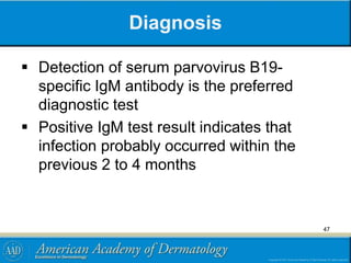 Diagnosis
 Detection of serum parvovirus B19-
specific IgM antibody is the preferred
diagnostic test
 Positive IgM test result indicates that
infection probably occurred within the
previous 2 to 4 months
47
 