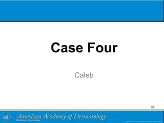 Case Four
Caleb
53
 