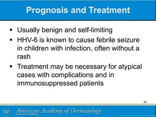 Prognosis and Treatment
 Usually benign and self-limiting
 HHV-6 is known to cause febrile seizure
in children with infection, often without a
rash
 Treatment may be necessary for atypical
cases with complications and in
immunosuppressed patients
60
 
