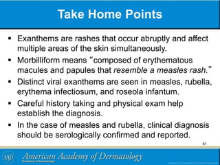 Take Home Points
 Exanthems are rashes that occur abruptly and affect
multiple areas of the skin simultaneously.
 Morbilliform means “composed of erythematous
macules and papules that resemble a measles rash.”
 Distinct viral exanthems are seen in measles, rubella,
erythema infectiosum, and roseola infantum.
 Careful history taking and physical exam help
establish the diagnosis.
 In the case of measles and rubella, clinical diagnosis
should be serologically confirmed and reported.
61
 