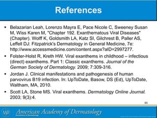 References
 Belazarian Leah, Lorenzo Mayra E, Pace Nicole C, Sweeney Susan
M, Wiss Karen M, "Chapter 192. Exanthematous Viral Diseases"
(Chapter). Wolff K, Goldsmith LA, Katz SI, Gilchrest B, Paller AS,
Leffell DJ: Fitzpatrick's Dermatology in General Medicine, 7e:
http://www.accessmedicine.com/content.aspx?aID=2997277.
 Folster-Holst R, Kreth HW. Viral exanthems in childhood – infectious
(direct) exanthems. Part 1: Classic exanthems. Journal of the
German Society of Dermatology. 2009; 7:309-316.
 Jordan J. Clinical manifestations and pathogenesis of human
parvovirus B19 infection. In: UpToDate, Basow, DS (Ed), UpToDate,
Waltham, MA, 2010.
 Scott LA, Stone MS. Viral exanthems. Dermatology Online Journal.
2003; 9(3):4.
65
 