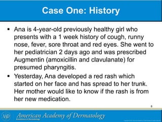 Case One: History
 Ana is 4-year-old previously healthy girl who
presents with a 1 week history of cough, runny
nose, fever, sore throat and red eyes. She went to
her pediatrician 2 days ago and was prescribed
Augmentin (amoxicillin and clavulanate) for
presumed pharyngitis.
 Yesterday, Ana developed a red rash which
started on her face and has spread to her trunk.
Her mother would like to know if the rash is from
her new medication.
8
 