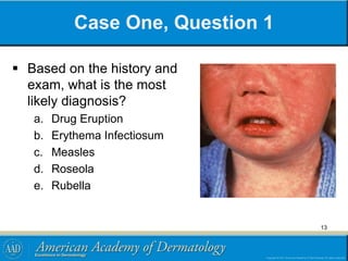 Viral exanthems-module