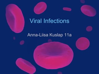 Viral Infections Anna-Liisa Kuslap 11a 