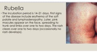 viral-infections.pdf