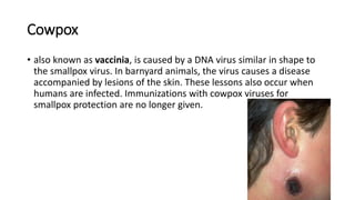 Cowpox
• also known as vaccinia, is caused by a DNA virus similar in shape to
the smallpox virus. In barnyard animals, the virus causes a disease
accompanied by lesions of the skin. These lessons also occur when
humans are infected. Immunizations with cowpox viruses for
smallpox protection are no longer given.
 
