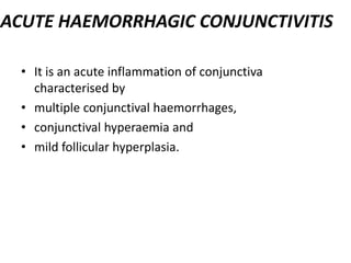 ACUTE HAEMORRHAGIC CONJUNCTIVITIS
• It is an acute inflammation of conjunctiva
characterised by
• multiple conjunctival haemorrhages,
• conjunctival hyperaemia and
• mild follicular hyperplasia.
 