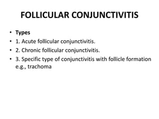 FOLLICULAR CONJUNCTIVITIS
• Types
• 1. Acute follicular conjunctivitis.
• 2. Chronic follicular conjunctivitis.
• 3. Specific type of conjunctivitis with follicle formation
e.g., trachoma
 