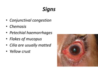 Signs
• Conjunctival congestion
• Chemosis
• Petechial haemorrhages
• Flakes of mucopus
• Cilia are usually matted
• Yellow crust
 