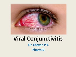 Viral Conjunctivitis
Dr. Chavan P.R.
Pharm D
 
