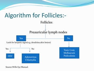 Algorithm for Follicles:-
Follicles
Preauricular lymph nodes
Look for herpetic signs(e.g. dendrites,skin lesion)
Yes No
Source:Wills Eye Manual.
Yes No
HSV Adenovirus
Chlamydia
Toxic Conj.
Molluscum
Pediculosis
 