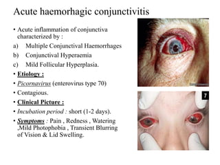Acute haemorhagic conjunctivitis
• Acute inflammation of conjunctiva
characterized by :
a) Multiple Conjunctival Haemorrhages
b) Conjunctival Hyperaemia
c) Mild Follicular Hyperplasia.
• Etiology :
• Picornavirus (enterovirus type 70)
• Contagious.
• Clinical Picture :
• Incubation period : short (1-2 days).
• Symptoms : Pain , Redness , Watering
,Mild Photophobia , Transient Blurring
of Vision & Lid Swelling.
 