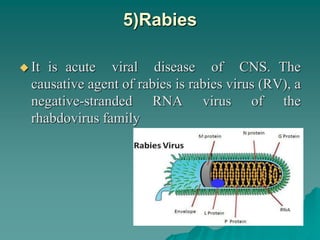 5)Rabies
 It is acute viral disease of CNS. The
causative agent of rabies is rabies virus (RV), a
negative-stranded RNA virus of the
rhabdovirus family
 