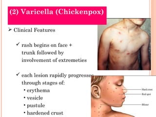 Viral diseases (3) | PPT