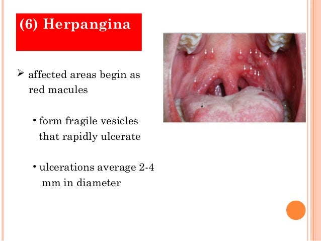 Viral Diseases 3 Viral Diseases 3