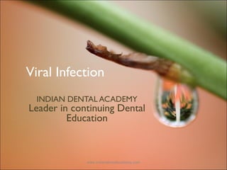 Viral Infection
INDIAN DENTAL ACADEMY
Leader in continuing Dental
Education
www.indiandentalacademy.com
 