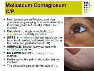 Pearl Rash Viral diseases of the skin (Other) | PPT