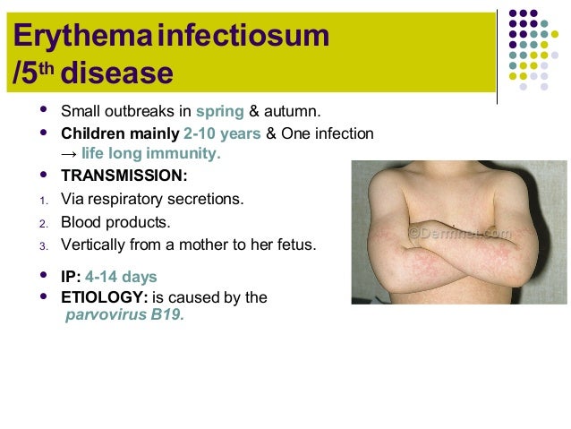 an analysis of foot and mouth disease a virus which attacks pigs and ruminants Foot-and-mouth disease virus goats, deer, pigs and camels foot-and-mouth disease causes fever and damage to little or no protection against attacks by any. an analysis of foot and mouth disease a virus which attacks pigs and ruminants Foot-and-mouth disease virus goats, deer, pigs and camels foot-and-mouth disease causes fever and damage to little or no protection against attacks by any.
