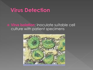  Virus isolation: inoculate suitable cell
culture with patient specimens
 
