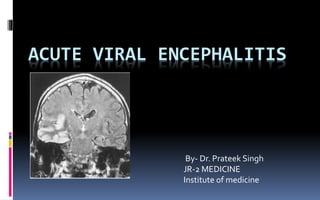 ACUTE VIRAL ENCEPHALITIS
By- Dr. Prateek Singh
JR-2 MEDICINE
Institute of medicine
 