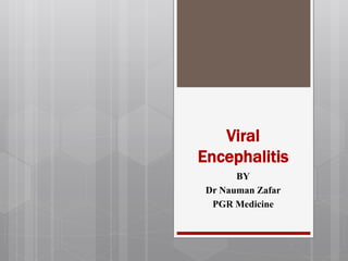 Viral
Encephalitis
BY
Dr Nauman Zafar
PGR Medicine
 