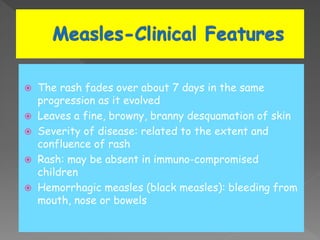  The rash fades over about 7 days in the same
progression as it evolved
 Leaves a fine, browny, branny desquamation of skin
 Severity of disease: related to the extent and
confluence of rash
 Rash: may be absent in immuno-compromised
children
 Hemorrhagic measles (black measles): bleeding from
mouth, nose or bowels
 