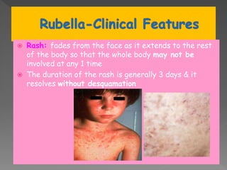  Rash: fades from the face as it extends to the rest
of the body so that the whole body may not be
involved at any 1 time
 The duration of the rash is generally 3 days & it
resolves without desquamation
 