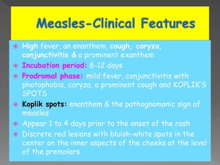  High fever, an enanthem, cough, coryza,
conjunctivitis & a prominent exanthem
 Incubation period: 8-12 days
 Prodromal phase: mild fever, conjunctivitis with
photophobia, coryza, a prominent cough and KOPLIK’S
SPOTS
 Koplik spots: enanthem & the pathognomonic sign of
measles
 Appear 1 to 4 days prior to the onset of the rash
 Discrete red lesions with bluish-white spots in the
center on the inner aspects of the cheeks at the level
of the premolars
 