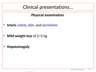 Clinical presentations…
Physical examination
• Icteric sclera, skin, and secretions
• Mild weight loss of 2–5 kg
• Hepatomegaly
Mohammed Adem
28
 